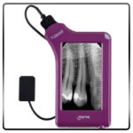 سنسور RVG مای ری MY RAY مدل X-POD