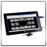 سنسور آرویجی RVG ایتیس EIGHTEETH مدل I-PAD